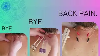 BYE BYE BACK PAIN! - Acupuncture, Electro-Stim, & Zodiac Tuning Forks for Lasting Relief!