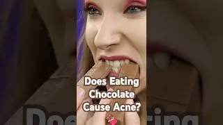 Does Eating Chocolate Cause Acne?