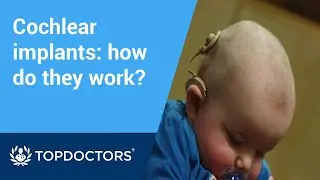 How do cochlear implants work? ||  What it sounds like