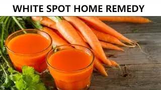 WHITE SPOTS on Skin Natural Home Remedy | Trunky