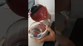 Globo ocular: Anatomía general del Ojo humano