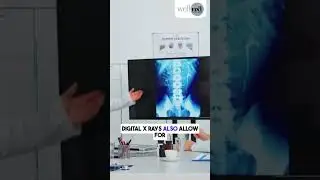 Digital X rays