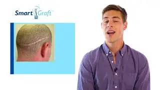 New What is FUE hair transplantation | New Jersey Plastic Surgery
