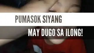 Nagnose bleed ba talaga si Rogun at Lumabas ang Super Powers niya? | WE ARE THE ROBINS PRANK