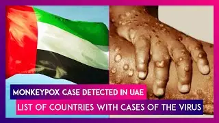 Monkeypox Case Detected In UAE, List Of Countries With Confirmed Cases Of The Virus
