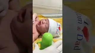 cute baby in NICU starting ist feeding #viral #baby #neonatologist #adorablebaby #babypics#newborn