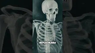 Тайна Перевала Дятлова &mdash; Кто их убил? #horror  #ai #scarystories #documentary #darkhistory #shorts