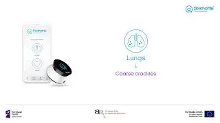 Lungs auscultation - coarse crackles #1