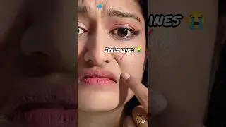 Smile Lines Hack 🤌😍#shorts #youtubeshorts #makeup #viral