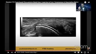 Gout | Case-based Discussions Made Easy | Learning Is Fun | Chapters In Description Box