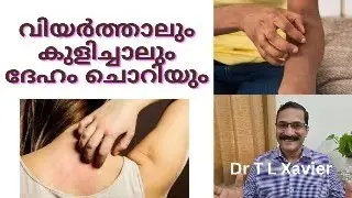 ദേഹം ചൊറിച്ചിൽ | Ayurveda for Skin Irritation and Itching
