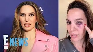 Christy Carlson Romano Hospitalized After Being Shot in the Eye | E! News