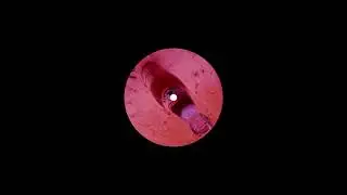 Mari Kvien Brunvoll - Everywhere You Go (Mike Plate Edit)