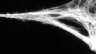 2-Photon Microscopic Imaging of Lifeact Actin in Neurons