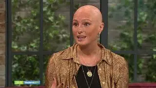ALOPECIA MODEL AMBER ROWAN