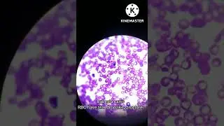 Babesia canis under microscope| Field stain used