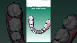 Aligner Software Training Course