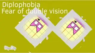 Phobiablocks band 31-40
