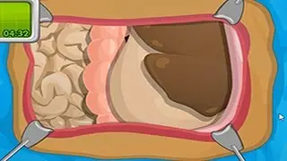 SHOVE IT DOWN HIS THROAT! | Stomach Surgery