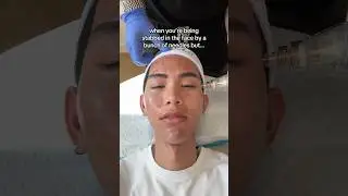 what I do when I&rsquo;m getting a PAINFUL skin treatment 😩🤳