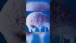 What a brain freeze actually is? #shorts