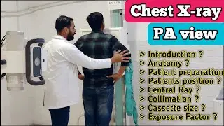 Chest X-ray कैसे किया जाता है ? Digital X-ray Chest PA view
