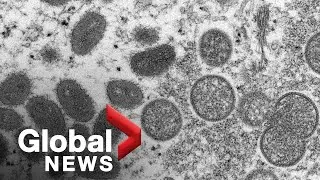 Monkeypox patterns of transmission 