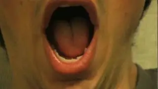 Viral