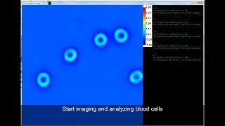 Real-time blood testing using Quantitative Phase Imaging