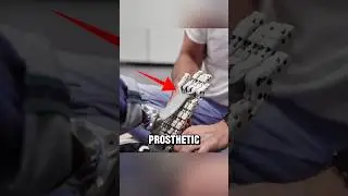 Протез, который ощущается как человек 🦿🦵🏻🤯
