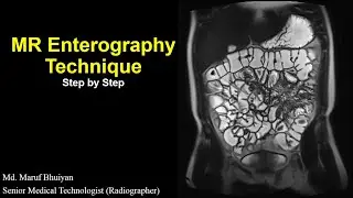 MR Enterography Technique Step by Step | Protocols | Planning | MR Enterogram Procedure |Preparation