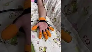 ▶️ Easy-use hand trainer for seniors and stroke patients  ( # 1902 ) @MaviGadgets Hand Trainer Glove