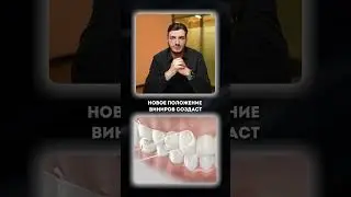 с ЭТИМ противопоказанием ВАМ НЕЛЬЗЯ ставить ВИНИРЫ!