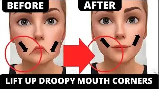Lift Jowls & Marionette Lines: No Surgery, Just Effective Face Exercises!
