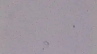 autoclave resistant contamination observed in water.AVI