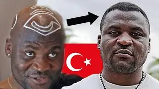 Francis Ngannou's Hair Transplant in Turkey with Now Hair Time