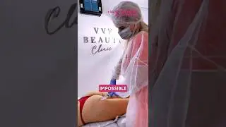 Dear clients, We are beauty clinic is looking for models for BBL procedure🤩🍑