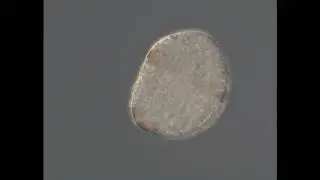 Amblyosyllis - Trochophore Larva