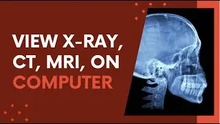 How to Open X-Ray, MRI & CT Scan (.DCM) Files on Windows Computer | DICOM Viewer