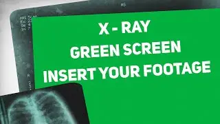 X-Ray Medical Green Screen | Graphics & Animation