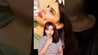 face dimple #makeup #trending #shorts #shortvideo #short #song #viralvideo #viral #video