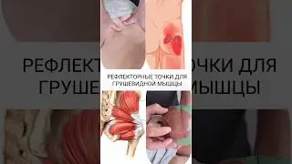 Рефлекторные точки при спазме грушевидной мышцы/ Синдром грушевидной мышцы/ Туннельная нейропатия