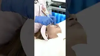 Hydrafacial Elite | Dermapuritys | Deep Cleansing | Instant Glow Treatment | Best Hydration Facial
