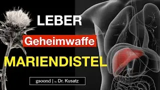 Mariendistel