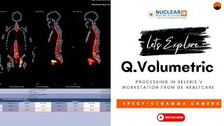 SPECT-CT processing with Q Volumetric Evolution in Xeleris Workstation