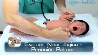 🌟PRENSIÓN PALMAR DEL RECIÉN NACIDO🌟