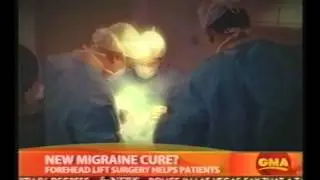 Forehead Lift Surgery Helps Migraine Patients - Dr. Bahman Guyuron