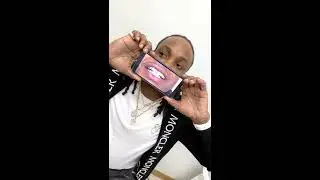Anthony's One Day Smile Makeover | Smile Obsession Experience