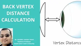 BACK VERTEX DISTANCE CALCULATION