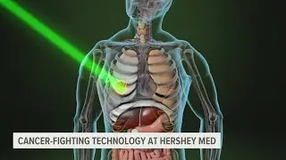 Hershey Medical Center gets 'game changing' new cancer treatment technology | Health Smart